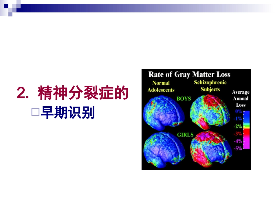 精神分裂症的诊断及治疗_第12页