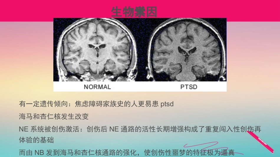 创伤后应激障碍参考PPT_第14页