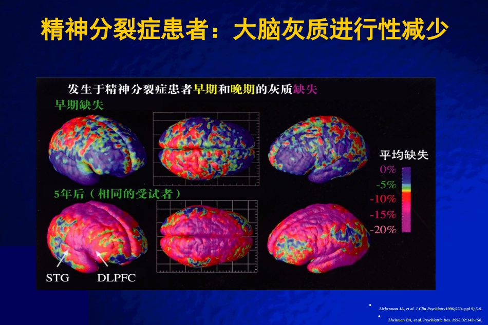 精神分裂症全病程治疗_第7页