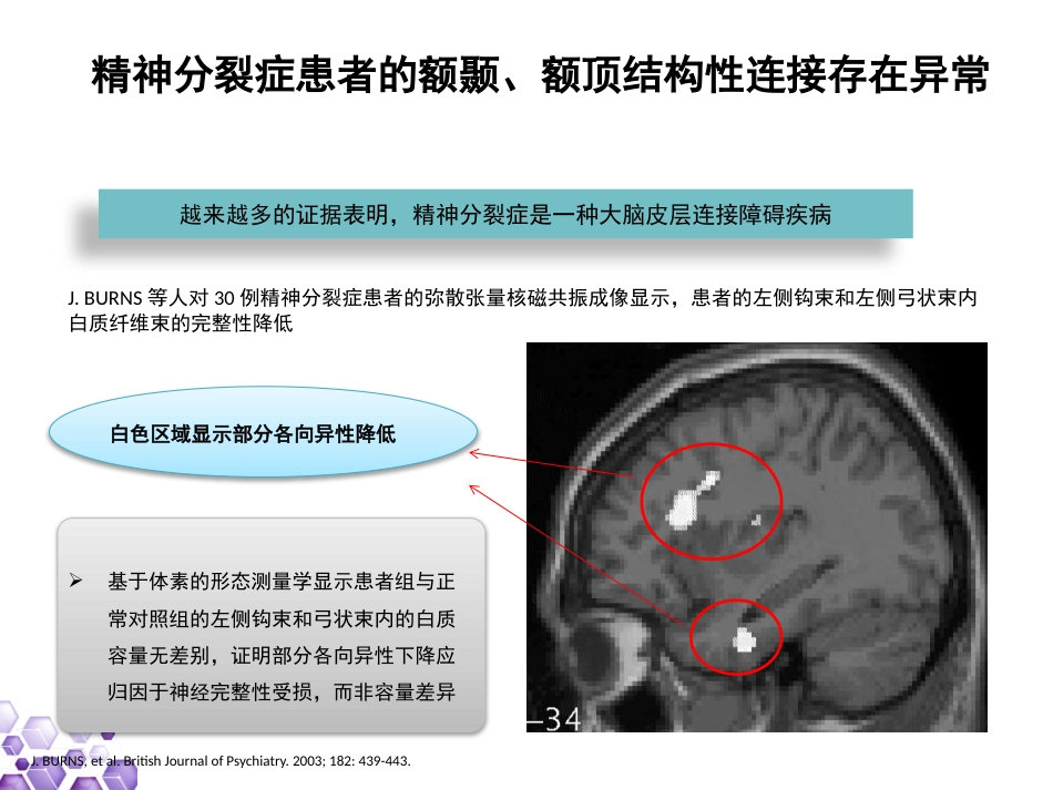 精神分裂症早期诊断与干预_第12页
