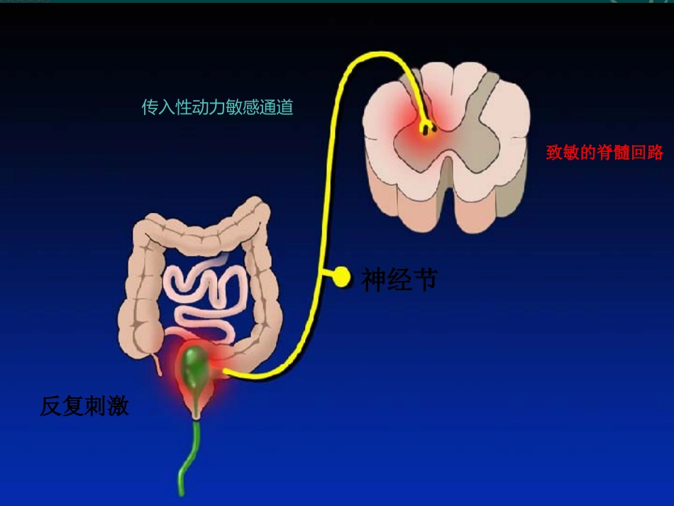肠易激综合症31页PPT_第7页