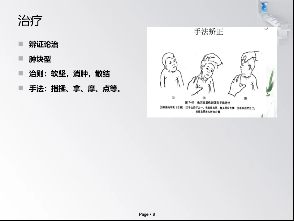 x小儿肌性斜颈_第8页