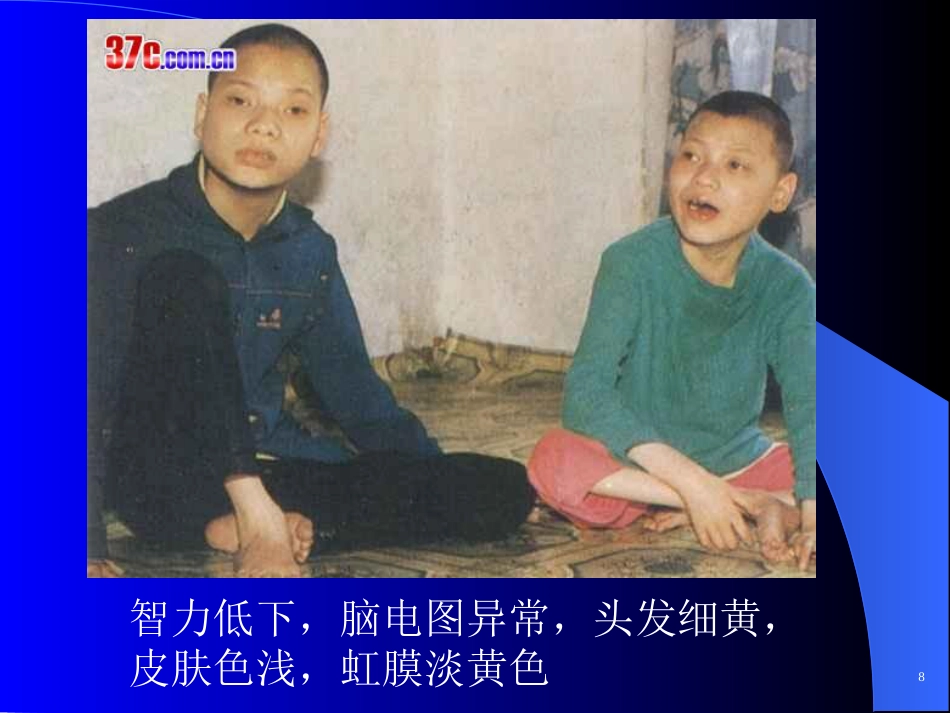 苯丙酮尿症、呆小症_第10页