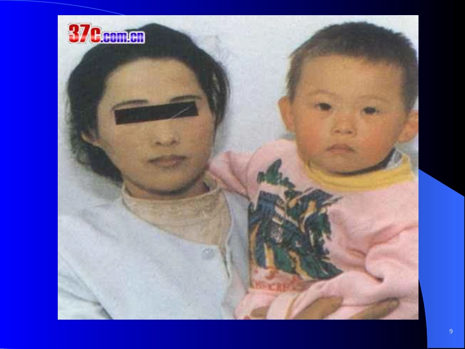 苯丙酮尿症、呆小症_第11页