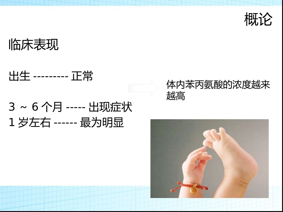 苯丙酮尿症_第6页