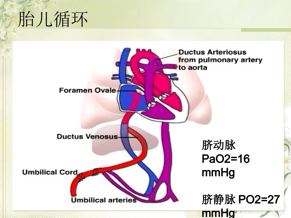 PPHN 新生儿持续肺动脉高压_第2页