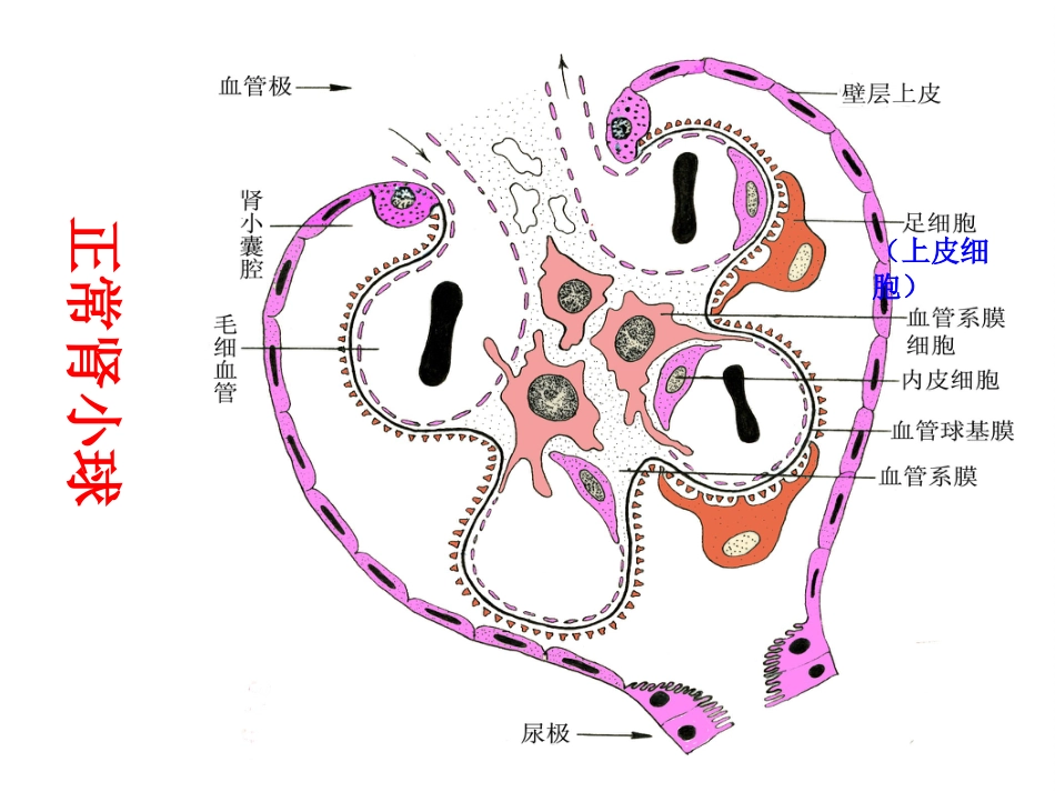 【儿科学】急性肾小球肾炎_第10页