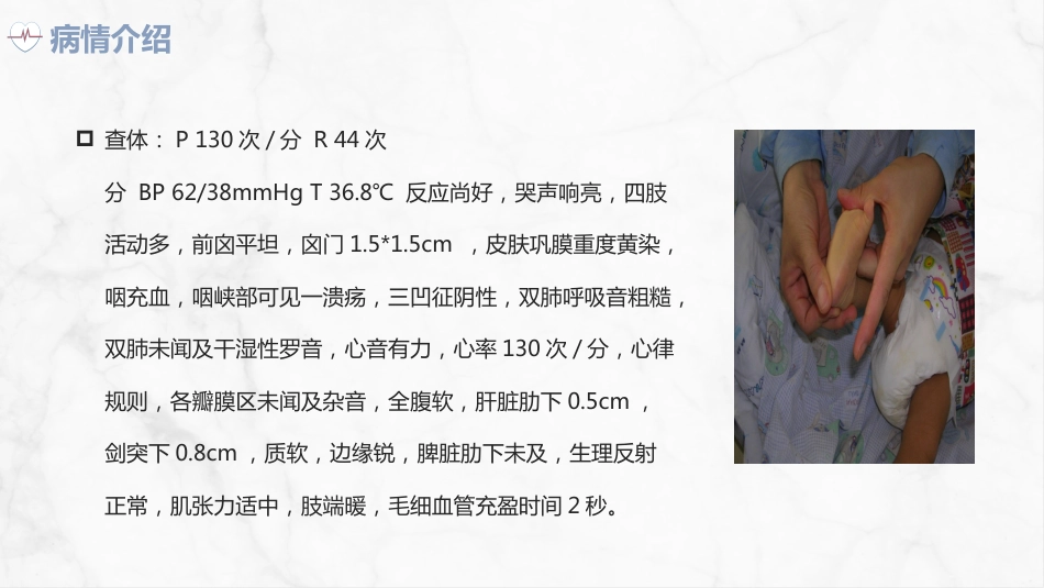 新生儿高胆红素血症护理查房_第11页