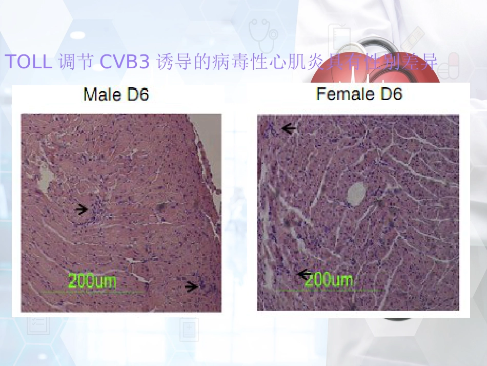 儿科 病毒性心肌炎_第11页