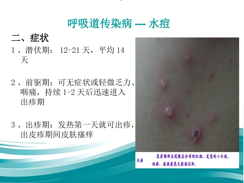儿科常见传染病及防护_第7页