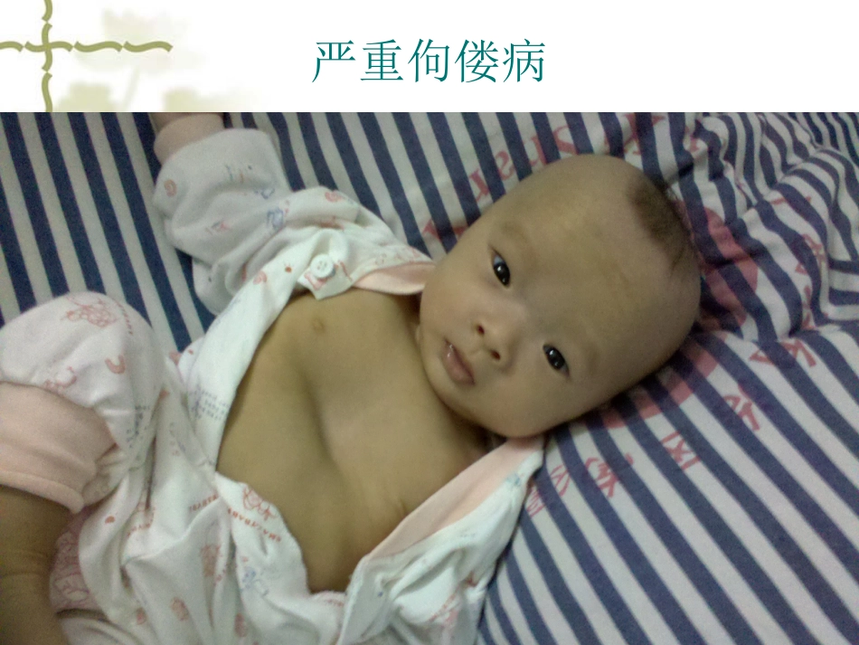 儿科病人营养评估及营养治疗循证_第6页