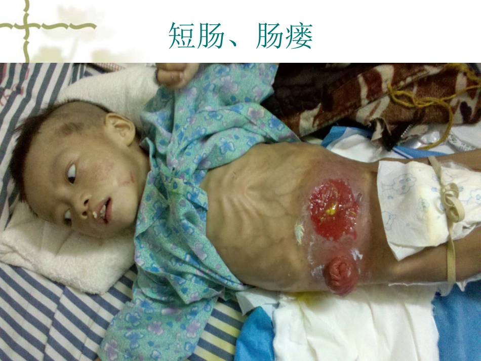儿科病人营养评估及营养治疗循证_第7页