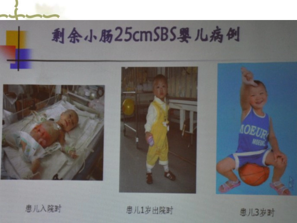 儿科病人营养评估及营养治疗循证_第9页
