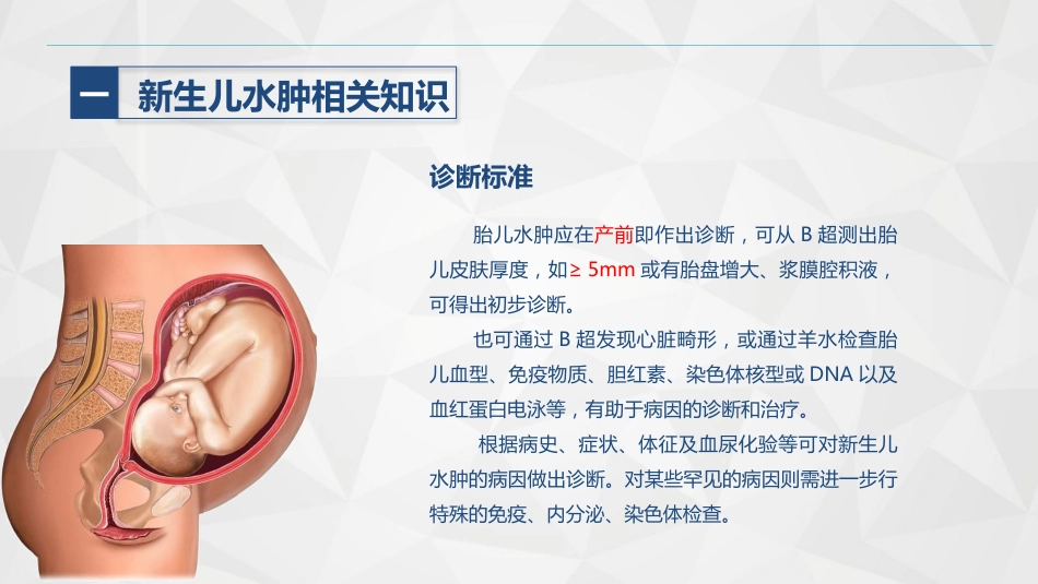 新生儿水肿的护理_第13页