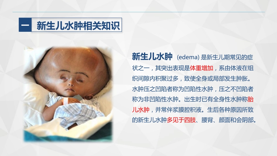 新生儿水肿的护理_第4页