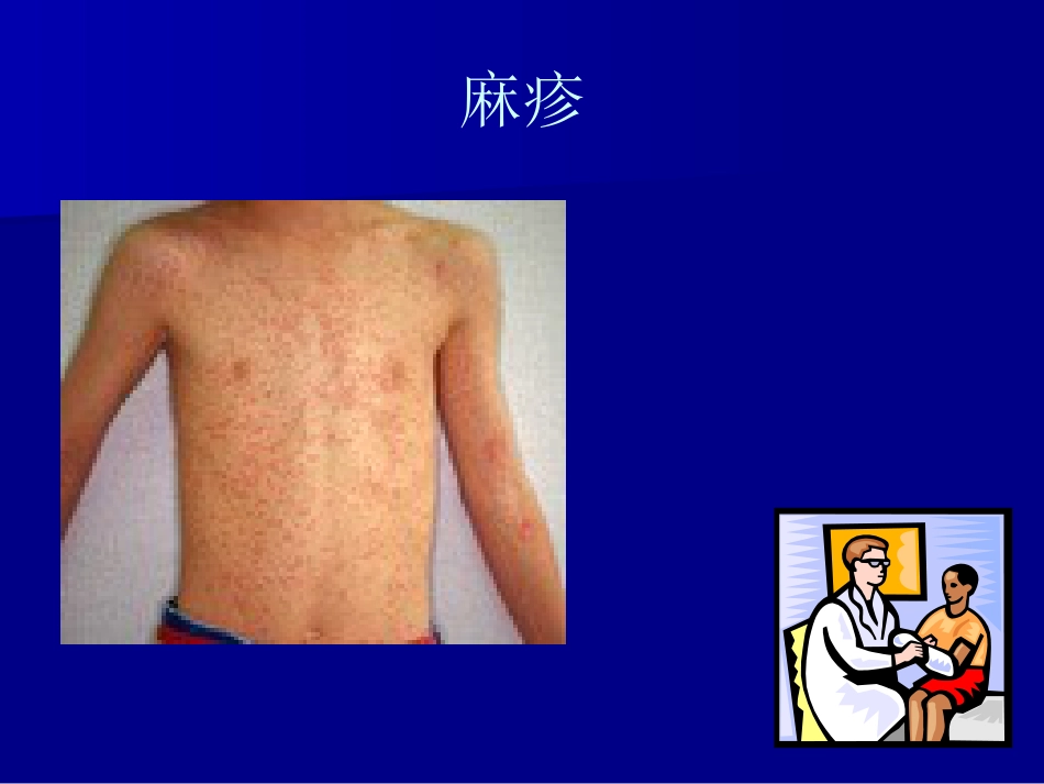 儿科常见传染病的防治_第9页