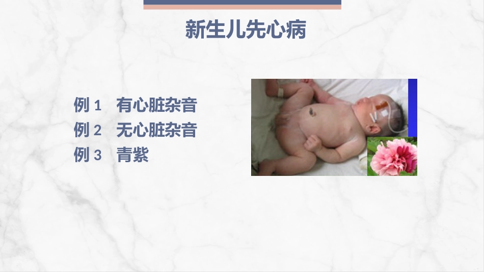 新生儿先天性心脏病病例讨论_第2页