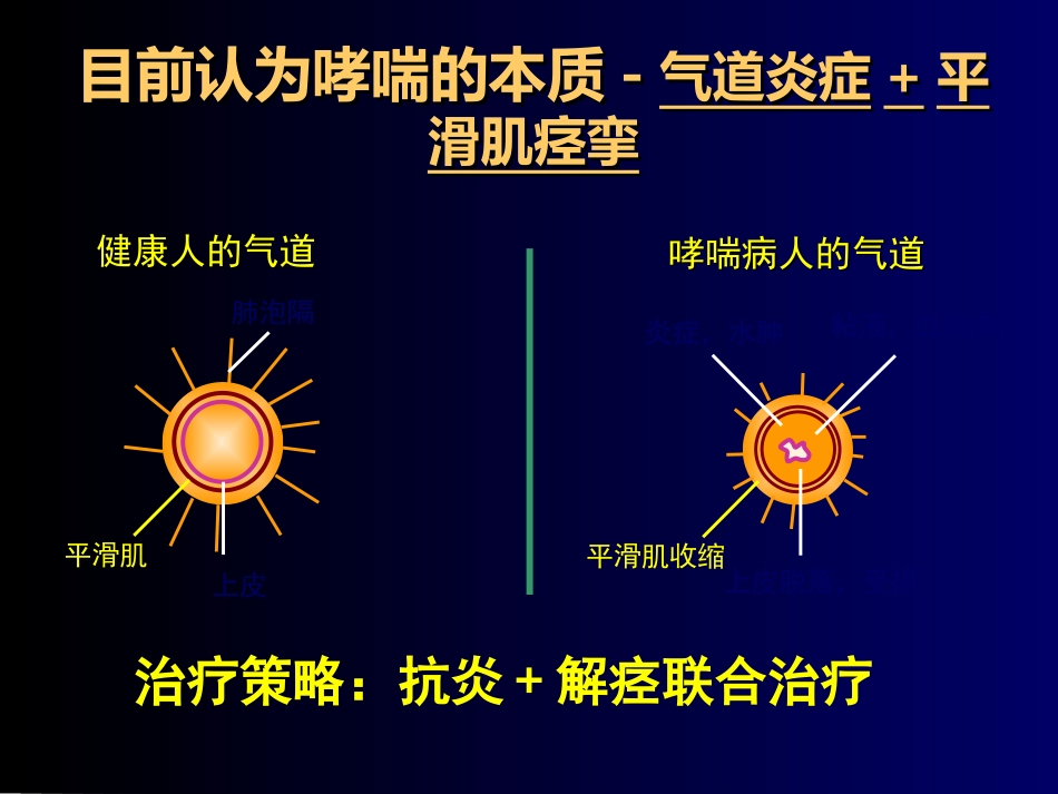 儿童哮喘的药物治疗-PPT课件_第14页