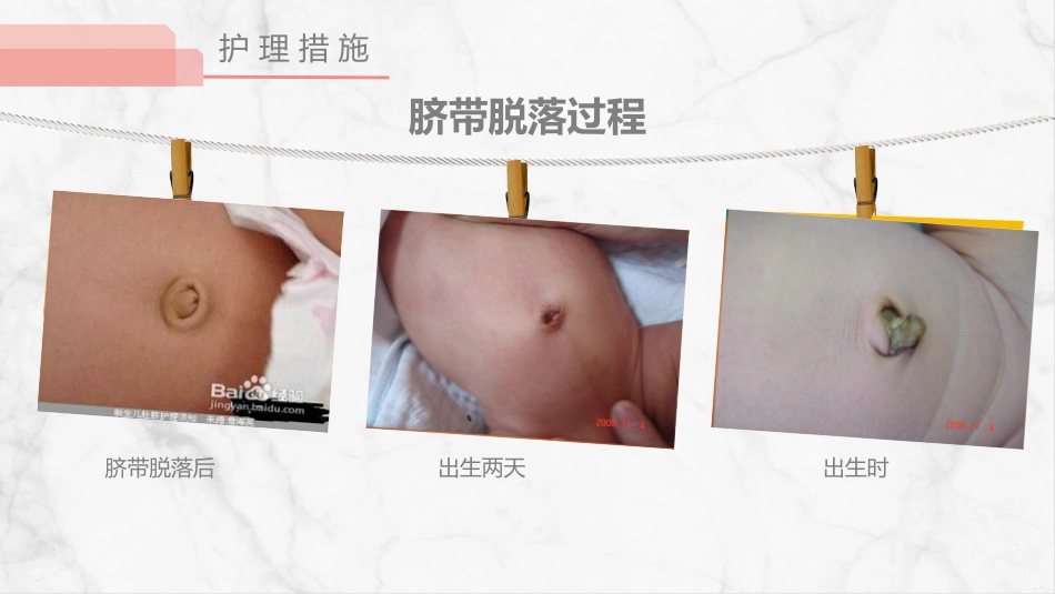 足月新生儿护理_第13页