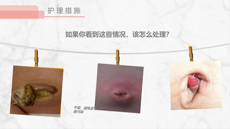 足月新生儿护理_第14页