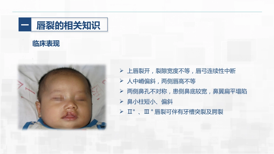 新生儿唇裂的护理+问题_第10页