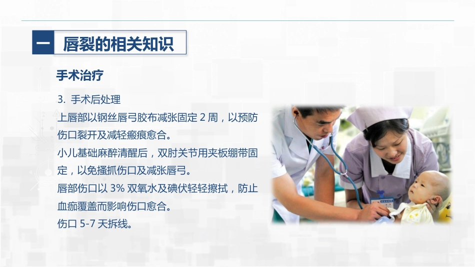 新生儿唇裂的护理+问题_第13页