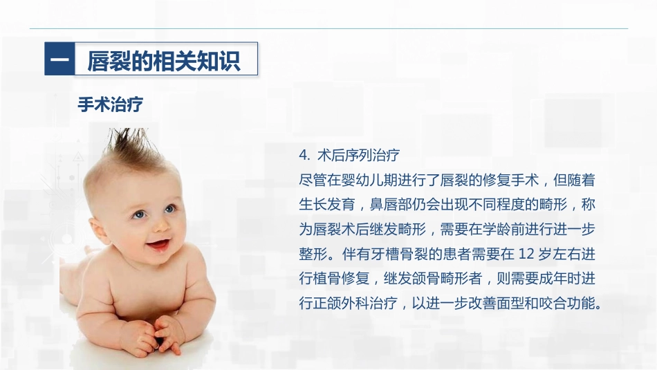 新生儿唇裂的护理+问题_第14页