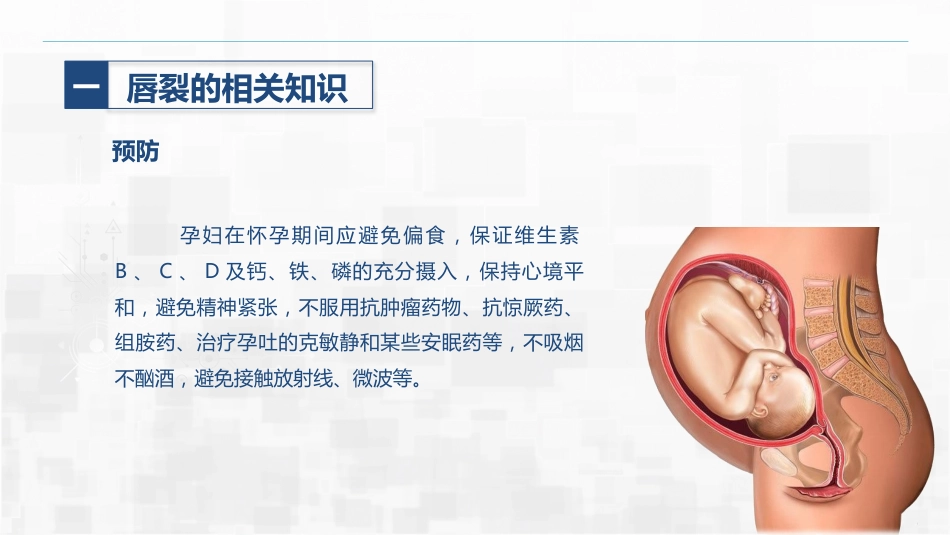 新生儿唇裂的护理+问题_第15页