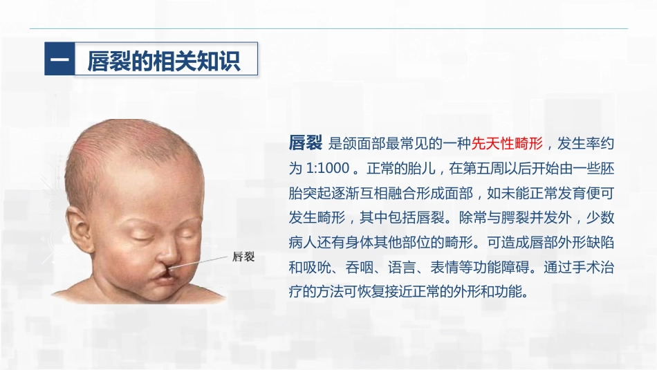 新生儿唇裂的护理+问题_第4页