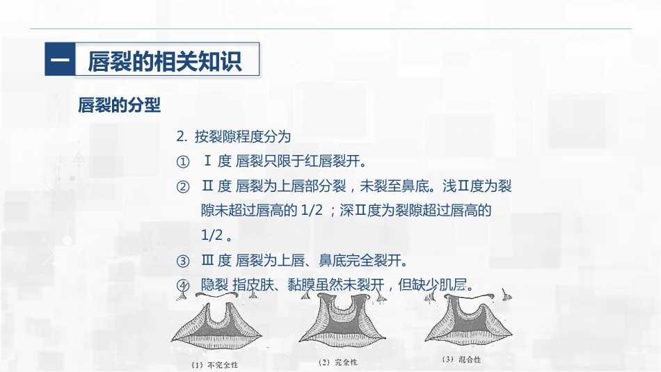 新生儿唇裂的护理+问题_第9页