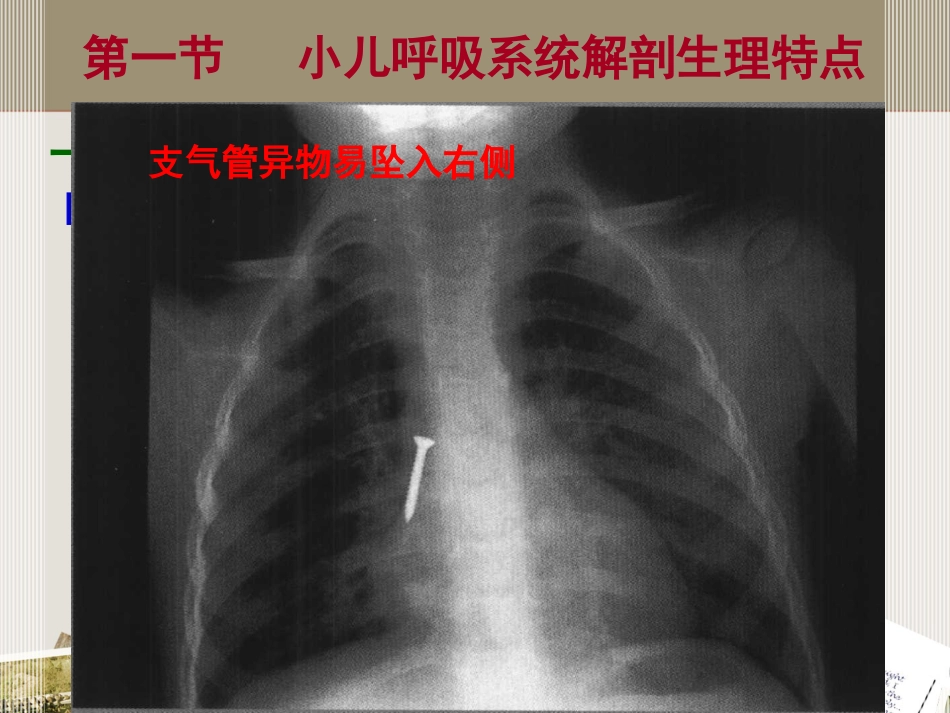 儿科 呼吸系统疾病_第6页