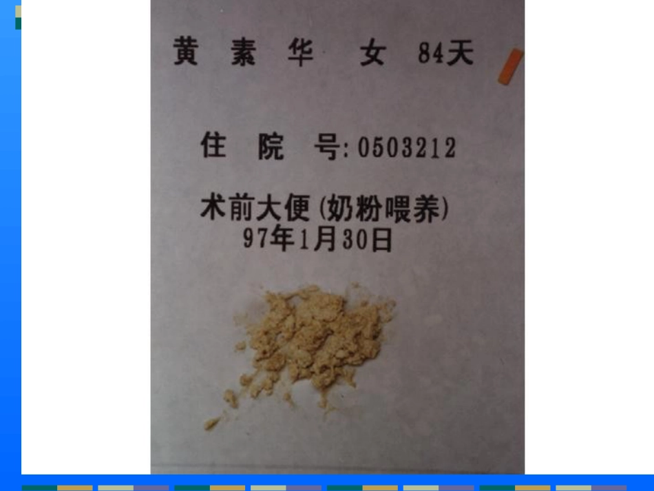 胆道闭锁儿科讲课课件课件_第15页