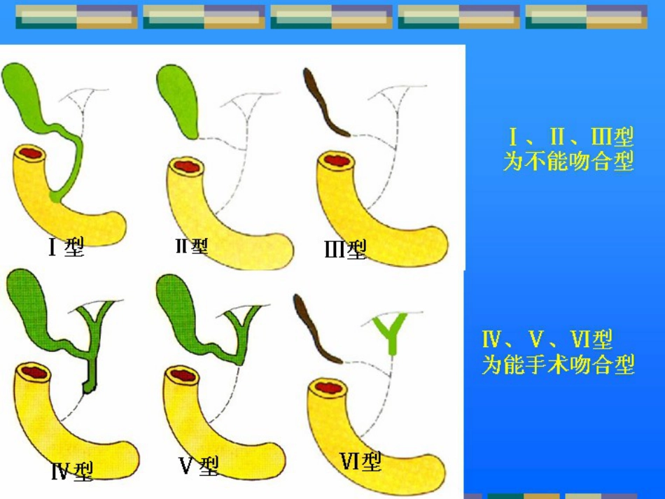 胆道闭锁儿科讲课课件课件_第8页