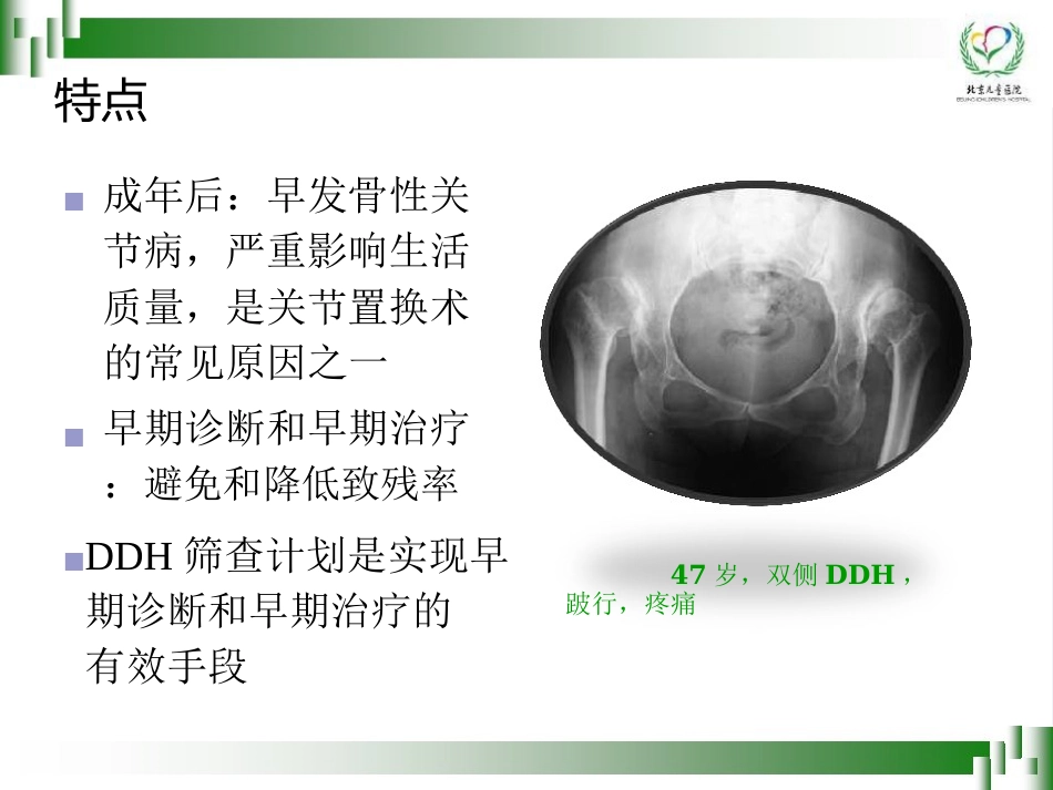 0-6岁儿童肢体残疾筛查技术(孙琳)_第11页