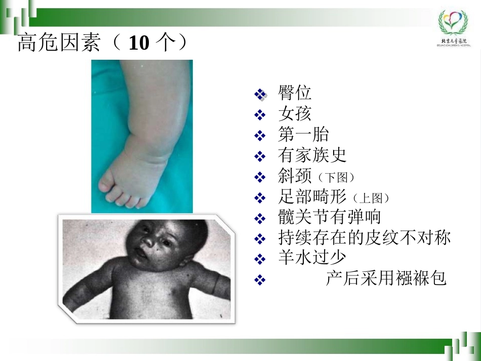 0-6岁儿童肢体残疾筛查技术(孙琳)_第12页