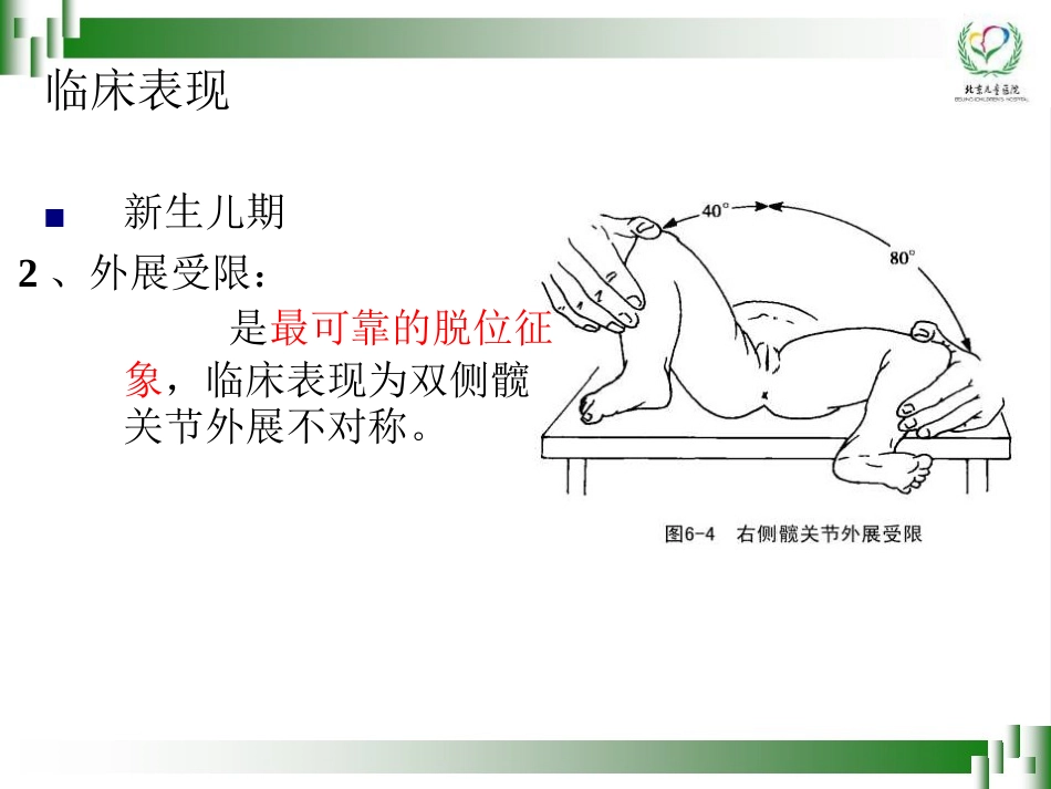 0-6岁儿童肢体残疾筛查技术(孙琳)_第14页