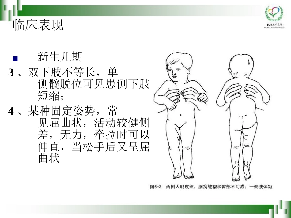 0-6岁儿童肢体残疾筛查技术(孙琳)_第15页