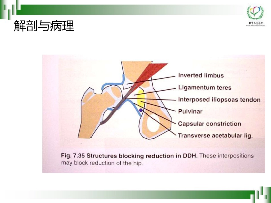 0-6岁儿童肢体残疾筛查技术(孙琳)_第7页