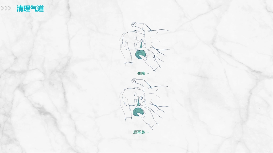 新生儿护理(1)_第11页