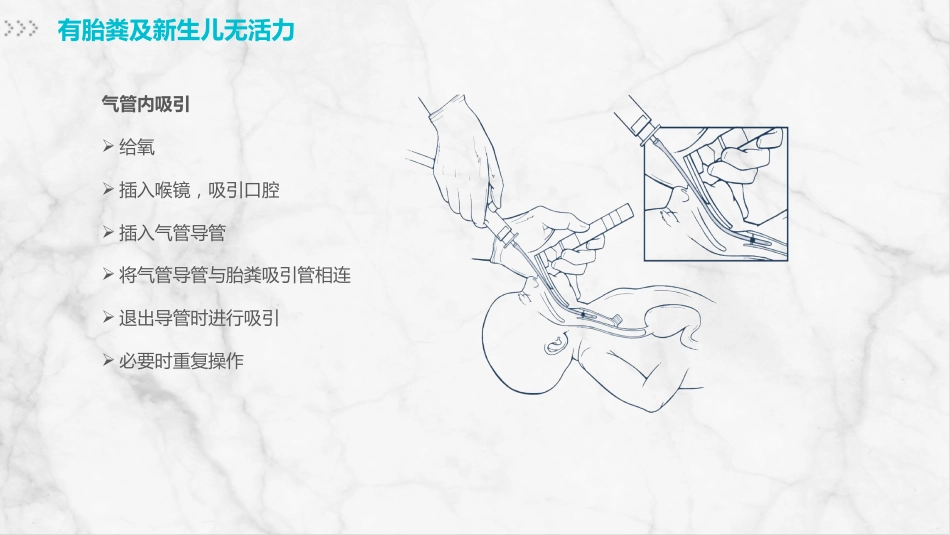 新生儿护理(1)_第14页