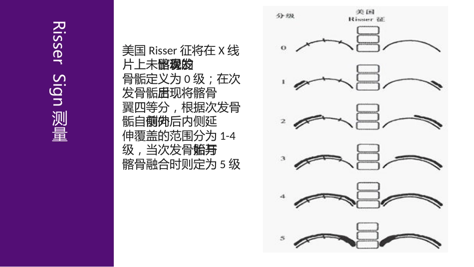 1儿童青少年脊柱筛查防控中心建设_第11页