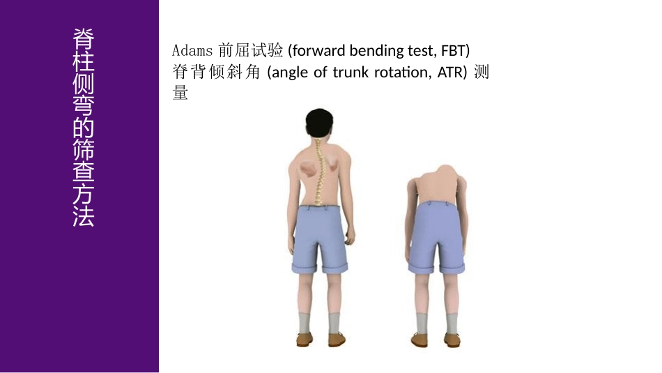 1儿童青少年脊柱筛查防控中心建设_第15页