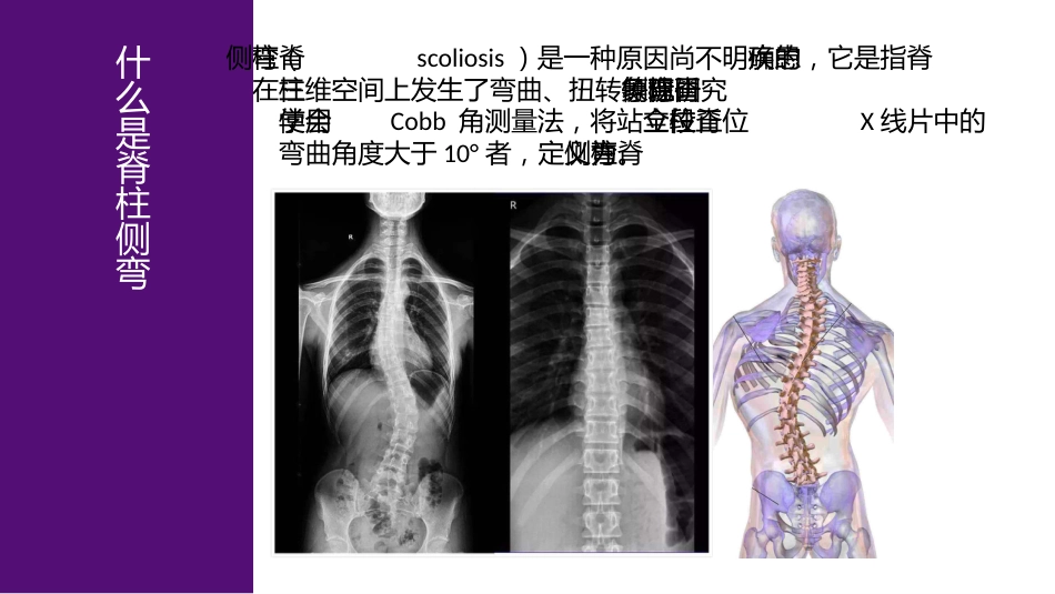 1儿童青少年脊柱筛查防控中心建设_第9页