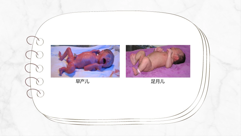 新生儿护理常规(1)_第7页