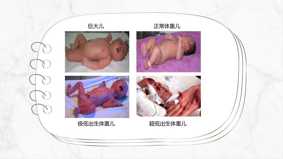 新生儿护理常规(1)_第9页