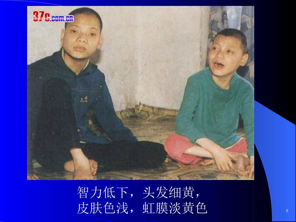 苯丙酮尿症 (2)_第9页