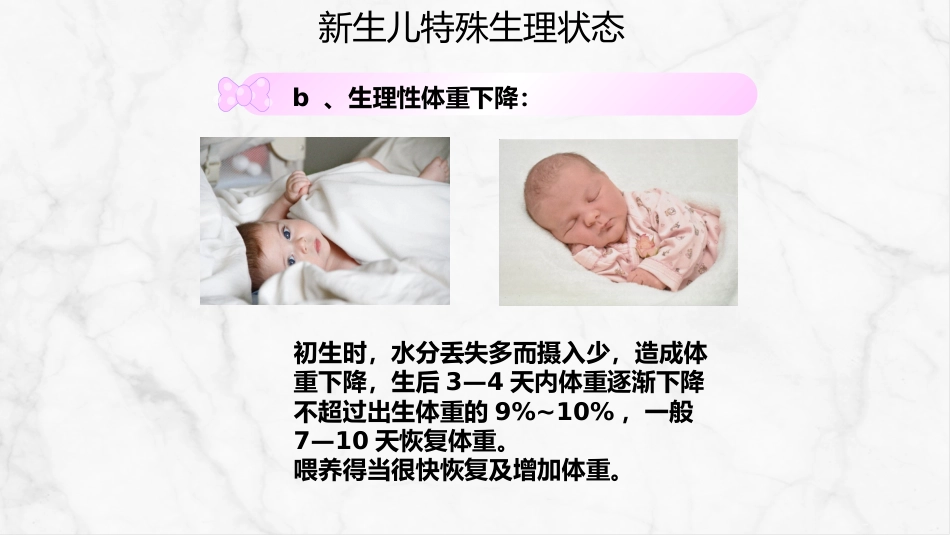 新生儿护理常规 (2)_第13页