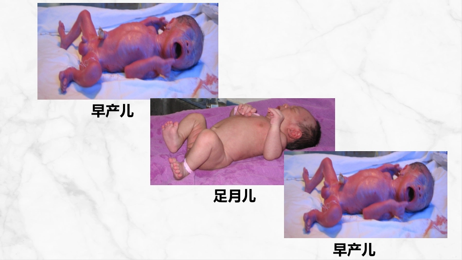 新生儿护理常规 (2)_第7页
