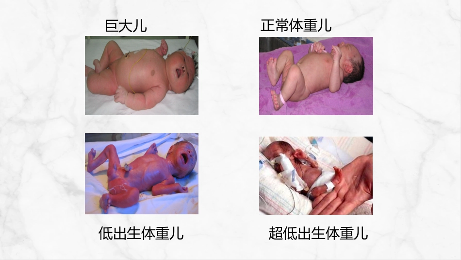 新生儿护理常规 (2)_第9页