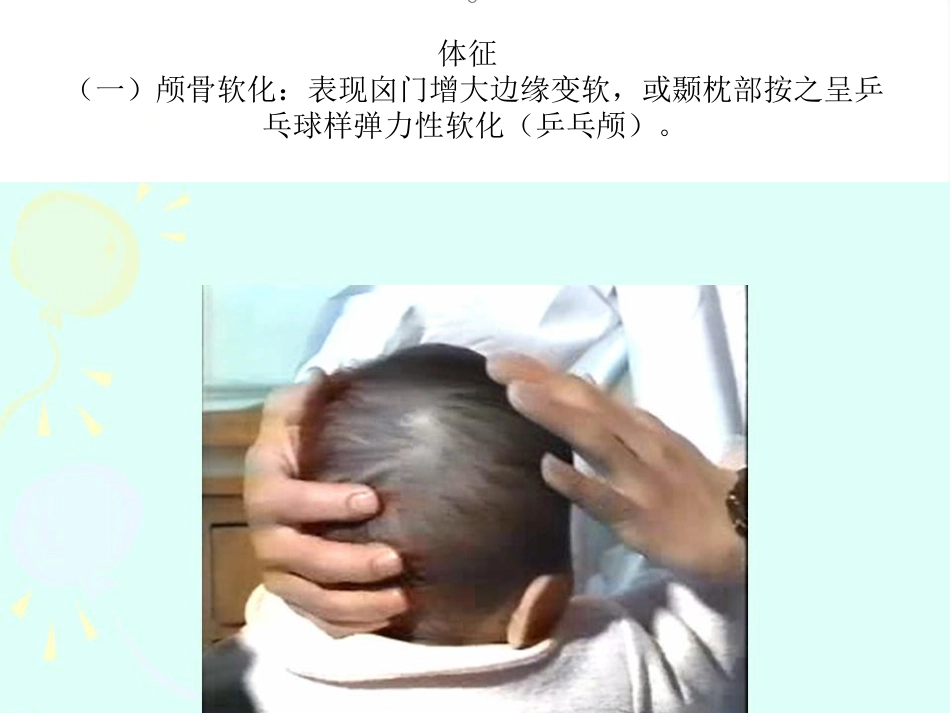 2016版佝偻病全球共识_第4页